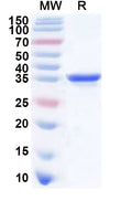 Recombinant Sindbis virus(SINV) nsp3 Protein, N-His