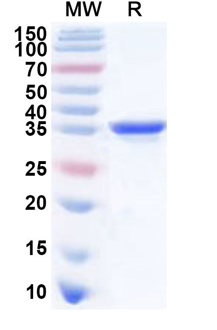 Recombinant Sindbis virus(SINV) nsp3 Protein, N-His