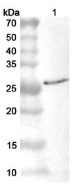 Western blot analysis was performed using anti-VP8-VACCW polyclonal antibody at 1ug/mL on various samples.
Lane 1: recombinant Vaccinia virus/VACV L4R/VP8 (Catalog No: VK005012)