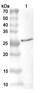 Western blot analysis was performed using anti-VP8-VACCW polyclonal antibody at 1ug/mL on various samples.
Lane 1: recombinant Vaccinia virus/VACV L4R/VP8 (Catalog No: VK005012)