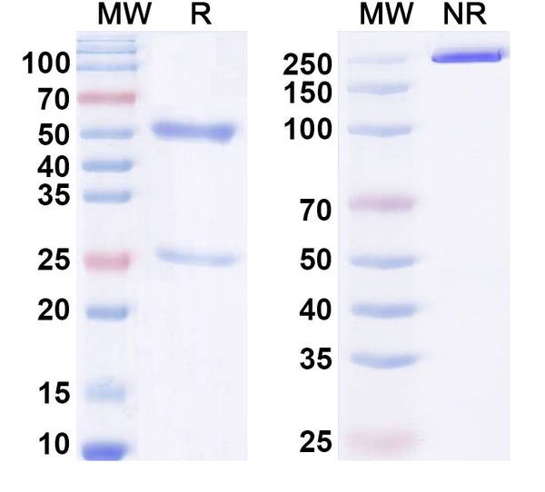 SDS-PAGE for Anti-HSV2/HHV2 gB/Envelope glycoprotein B Antibody (SAA2248)