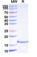 SDS-PAGE for Anti-HPIV-3 Fusion glycoprotein F0 Nanobody (SAA2258)