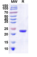 Recombinant Oropouche virus/OROV Glycoprotein G2, N-His