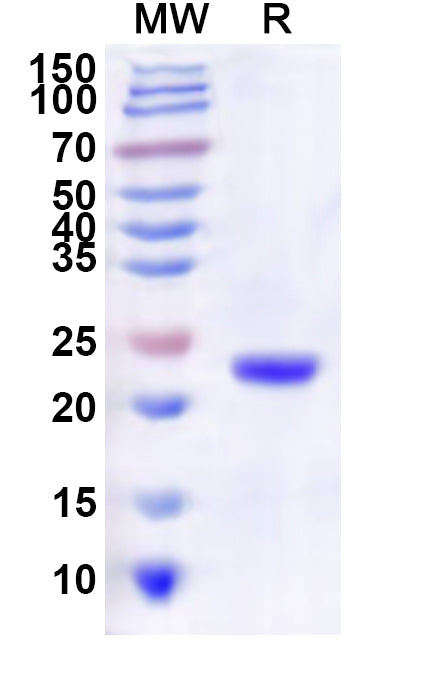 Recombinant Oropouche virus/OROV Glycoprotein G2, N-His