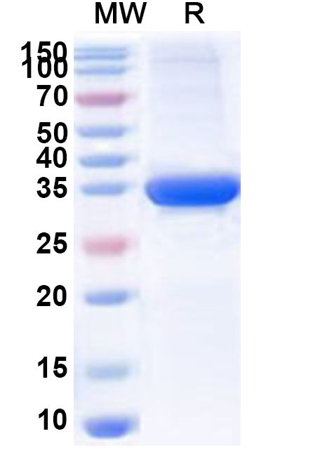 Recombinant Sapporo virus NS1 Protein, N-GST & C-His