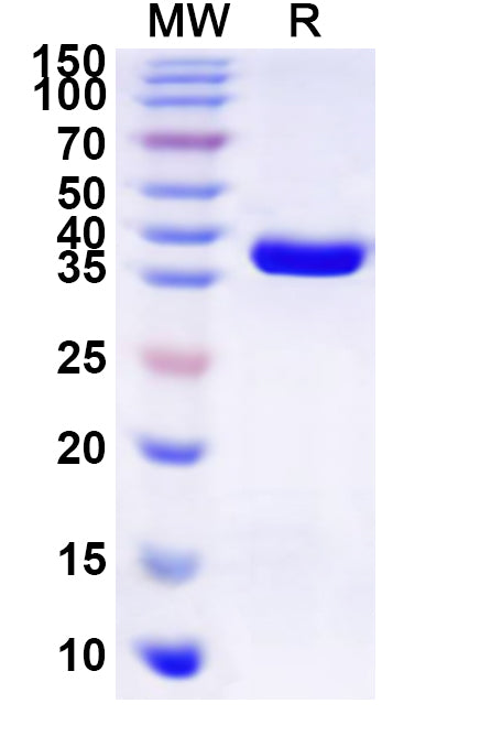 Recombinant Sapporo virus VPg Protein, N-GST & C-His