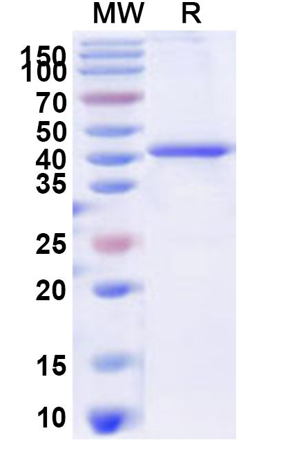 Recombinant IBV nsp3 Protein, N-His