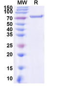 Recombinant Avian myelocytomatosis virus MYC Protein, N-His-KSI