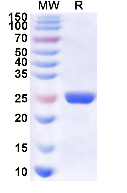 Recombinant FHV-1 capsid maturation protease, N-His