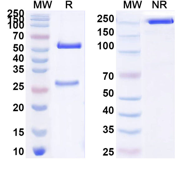 SDS-PAGE for Anti-HAstV-2 Spike Protein Antibody (4B6)