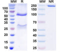 SDS-PAGE for Anti-HAstV-1 Spike Protein Antibody (3H4)