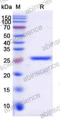 SDS-PAGE for Lambda Protein Phosphatase (Lambda PP)