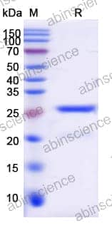 SDS-PAGE for Lambda Protein Phosphatase (Lambda PP)