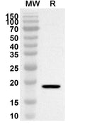 Western blot analysis was performed using anti-CSFV N-Pro polyclonal antibody at 1ug/mL on recombinant CSFV N-Pro (Catalog No. VK404012).
