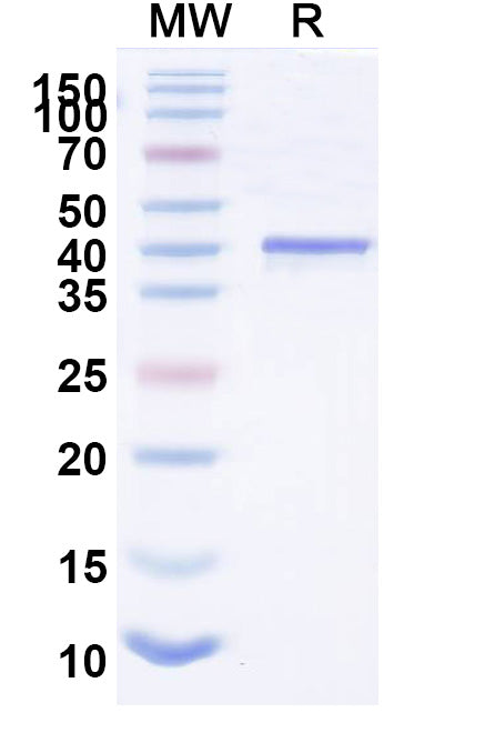 Recombinant Nipah virus/NiV M/Matrix Protein, N-His
