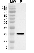 Western blot analysis was performed using anti-HPV52 E6/Protein E6 polyclonal antibody at 1ug/mL on recombinant HPV52 E6/Protein E6 (Catalog No. VK412012).