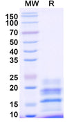 Recombinant Monkeypox virus/MPXV A29L Protein, C-His