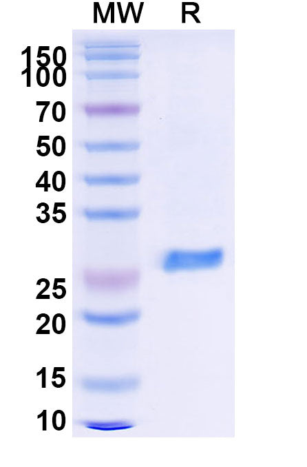 Recombinant Monkeypox virus/MPXV A29L Protein, N-GST & C-His