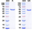 Anti-HRSV Fusion Protein Reference Antibody (Gontivimab) – Figure 1 of 1