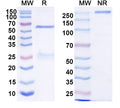SDS-PAGE for Anti-HRSV-A F/Fusion glycoprotein F0 Antibody (14N4)
