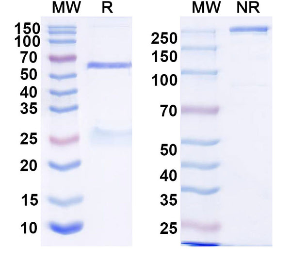 SDS-PAGE for Anti-HRSV-A F/Fusion glycoprotein F0 Antibody (14N4)