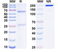 SDS-PAGE for Anti-HRSV-A F/Fusion glycoprotein F0 Antibody (101F).