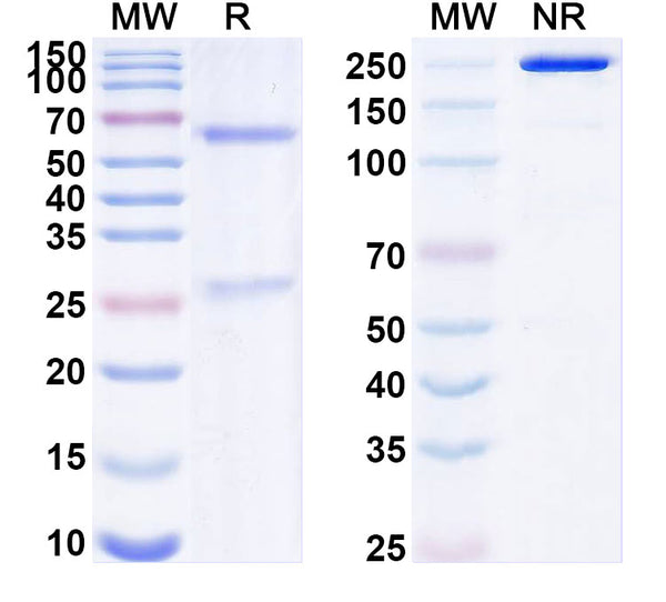 SDS-PAGE for Anti-HRSV-A F/Fusion glycoprotein F0 Antibody (101F).