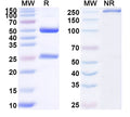 SDS-PAGE for Anti-HRSV F Protein Antibody (131-2A).
