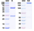 SDS-PAGE for Anti-HRSV-A/B F Protein Antibody (RB1).