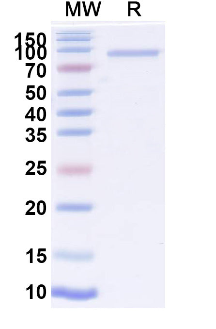 Recombinant CHIKV Spike glycoprotein E1 Protein, C-Fc