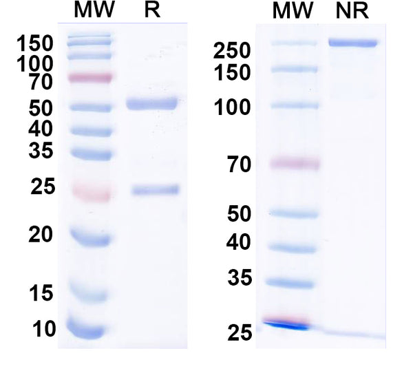 SDS-PAGE for Anti-CHIKV p130/Structural polyprotein Antibody (DC2.112).