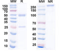 SDS-PAGE for Anti-CHIKV p130/Structural polyprotein Antibody (DC2.315).