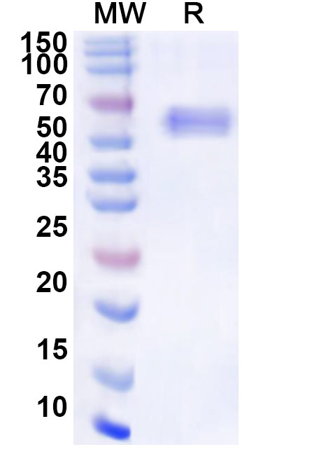 Recombinant Nipah virus/NiV Protein N/Nucleoprotein Protein, N-His