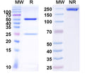 SDS-PAGE for Anti-Coxsackievirus A16/CVA16 Capsid protein/Genome polyprotein Antibody (SAA0355).