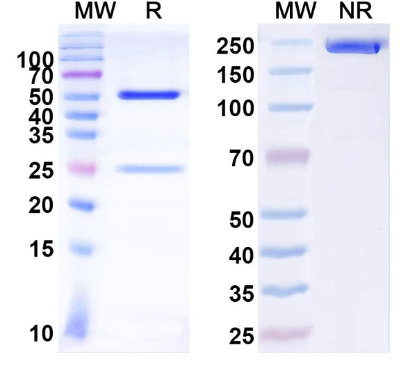 SDS-PAGE for Anti-Coxsackievirus A16/CVA16 Capsid protein/Genome polyprotein Antibody (SAA0355).