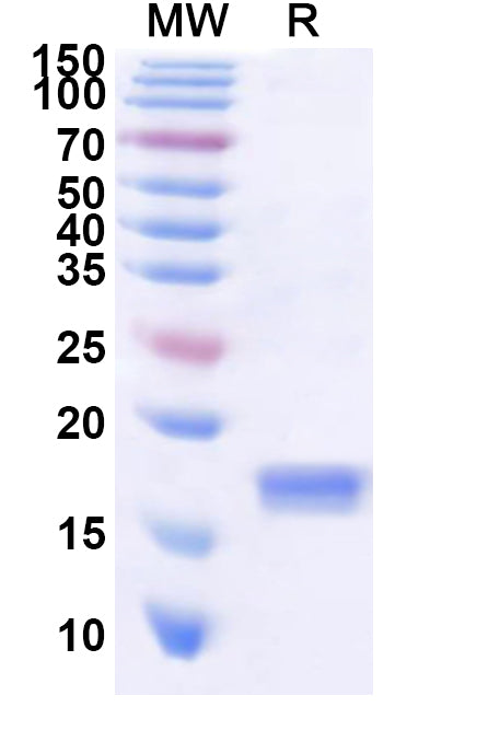 Recombinant CA16 P2A/Protease 2A Protein, N-His