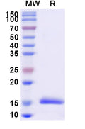 SDS-PAGE for Anti-Vesicular stomatitis Indiana virus/VSIV NP/Nucleoprotein Nanobody (SAA1125)