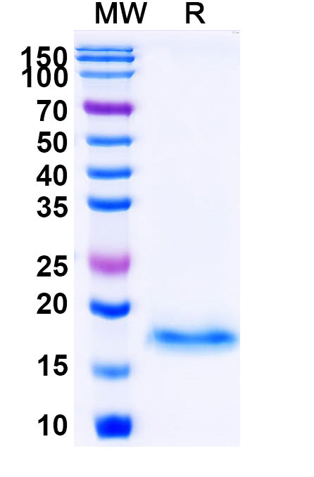 SDS-PAGE for Anti-Vesicular stomatitis Indiana virus/VSIV NP/Nucleoprotein Nanobody (SAA1193).