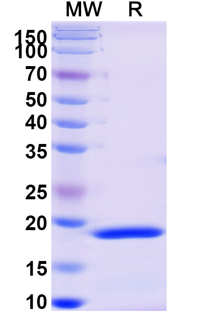 Recombinant Monkeypox virus/MPXV F3L Protein, N-His