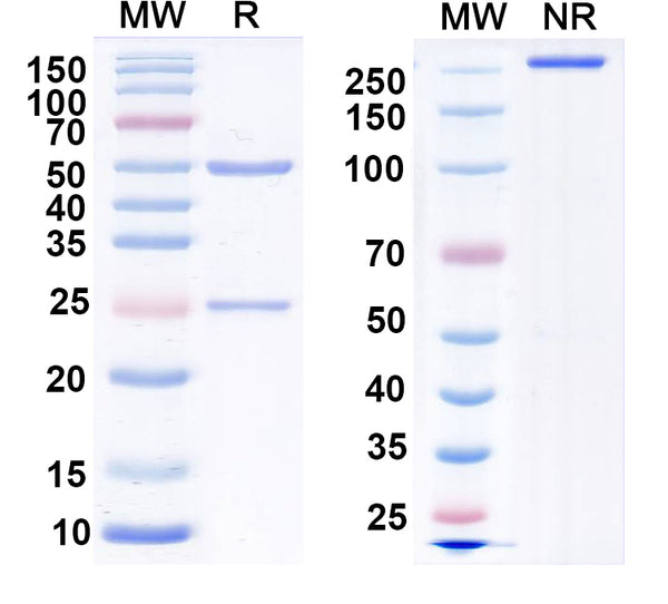 SDS-PAGE for Anti-Vaccinia virus/VACV H3L/Ag35 Antibody (B9).