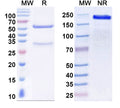 SDS-PAGE for Anti-Norovirus/Norwalk virus Capsid protein Antibody (5B18).