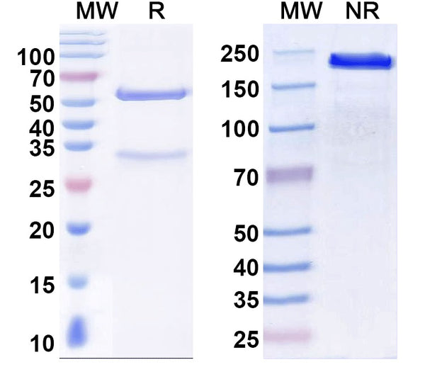 SDS-PAGE for Anti-Norovirus/Norwalk virus Capsid protein Antibody (5B18).