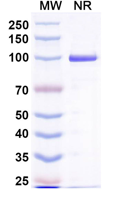 SDS-PAGE for Anti-Norovirus/Norwalk virus Capsid protein/VP1 Antibody (Nano-4).