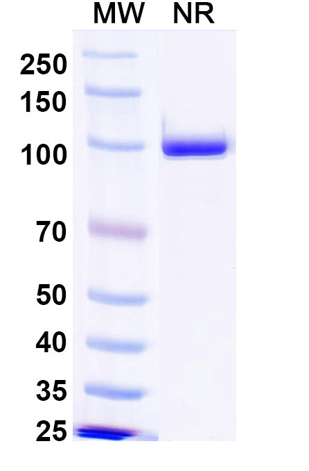 SDS-PAGE for Anti-Norovirus/Norwalk virus Capsid protein/VP1 Antibody (Nano-25).