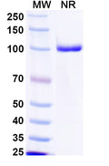 SDS-PAGE for Anti-Norovirus/Norwalk virus Capsid protein VP1/p59 Antibody (Nano-7).
