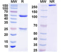 SDS-PAGE for Anti-Norovirus/Norwalk virus Major capsid protein/VP1 Antibody (A1227)