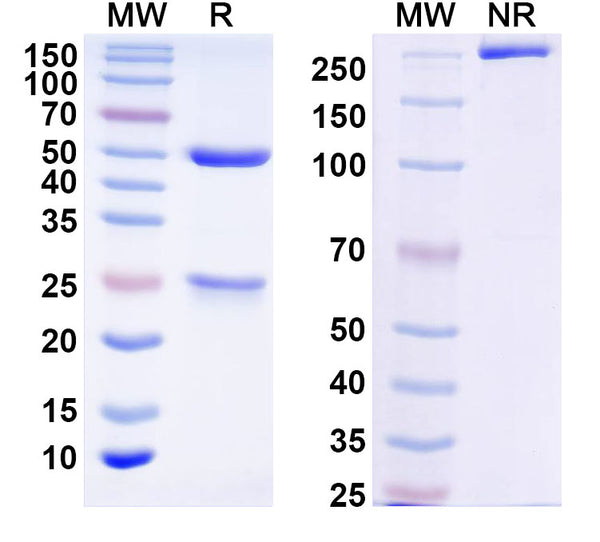 SDS-PAGE for Anti-Norovirus/Norwalk virus Major capsid protein/VP1 Antibody (A1227)