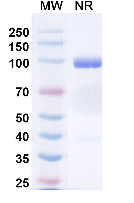 SDS-PAGE for Anti-Norovirus/Norwalk virus Capsid protein/VP1 Antibody (M4)