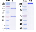 SDS-PAGE for Anti-Norovirus/Norwalk virus Capsid protein/VP1 Antibody (NORO-320)