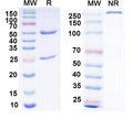 SDS-PAGE for Anti-Vaccinia virus/VACV B5R Antibody (SAA0315).